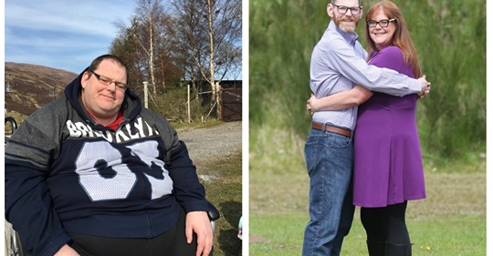 Самый толстый британец похудел на 270 кг, потому что боялся раздавить жену в постели