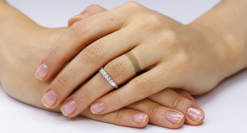 Проблемы с украшением или здоровьем: почему появляются темные круги на пальце от кольца