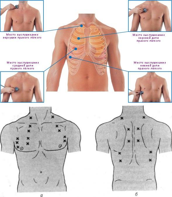 Точки аускультации легких схема