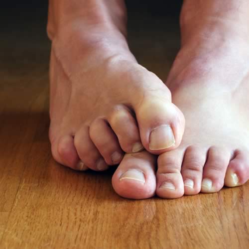 Дезодорант для ног: обзор, особенности выбора и рекомендации