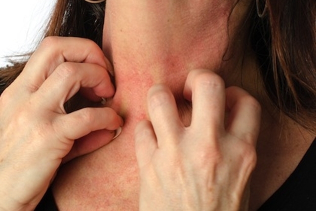 Аллергия на глютен: симптомы, диагностика и лечение