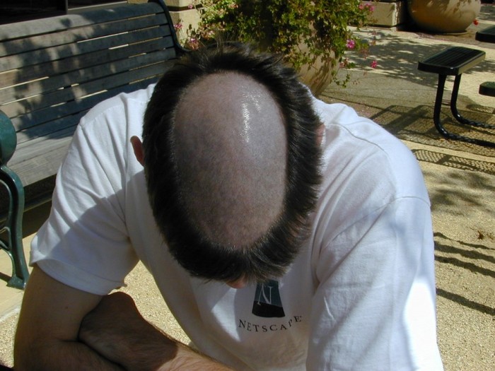 Почему католические монахи бреют голову