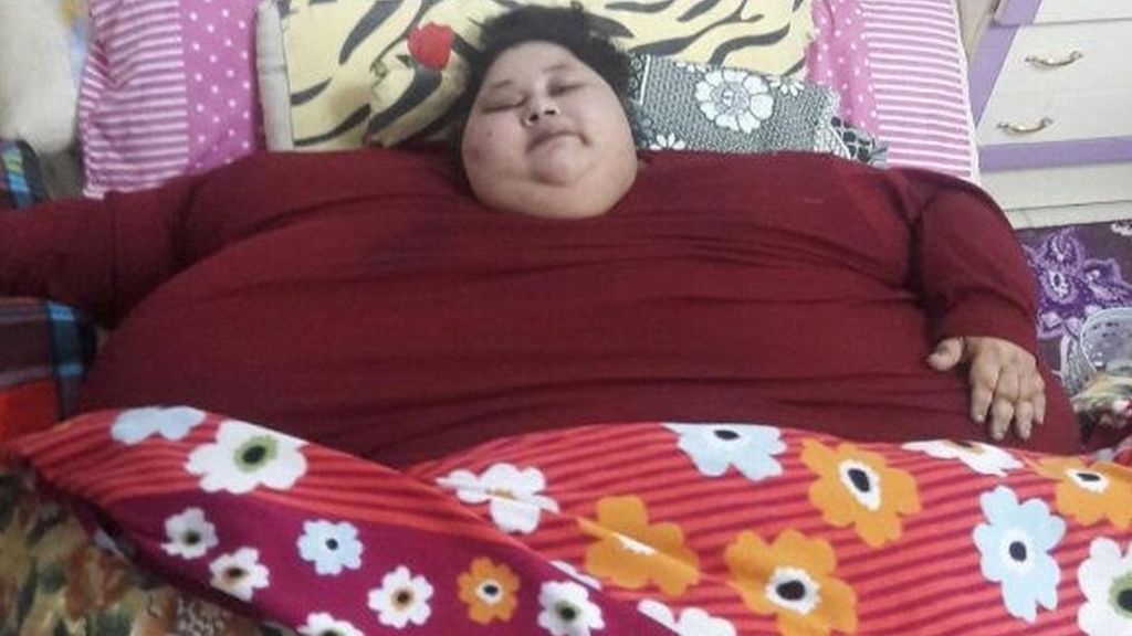 Эта женщина за 2 месяца потеряла 323 кг, сделав операцию для похудения. Но все оказалось куда сложнее, чем она хотела…
